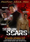 Serbian Scars