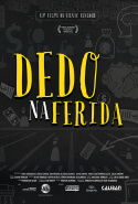 Dedo na Ferida
