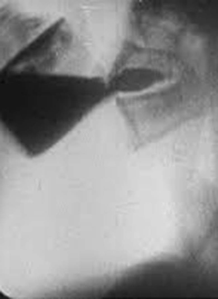 Roentgenfilm I i gruppen Alla filmer hos Mohamad shop (516718)