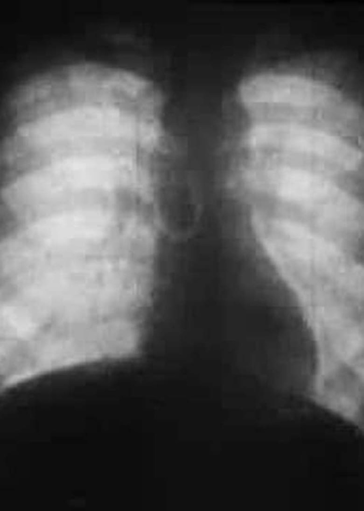 Roentgenfilm II i gruppen Alla filmer hos Mohamad shop (516719)