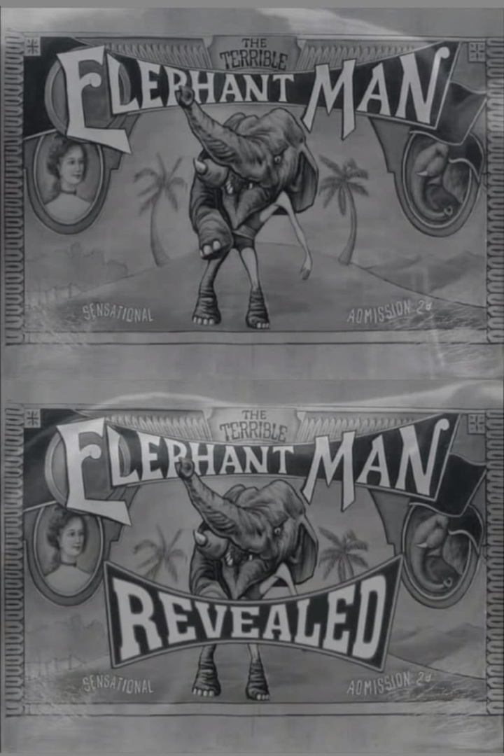 The Terrible Elephant Man Revealed i gruppen Alla filmer / Documentary hos Mohamad shop (616849)