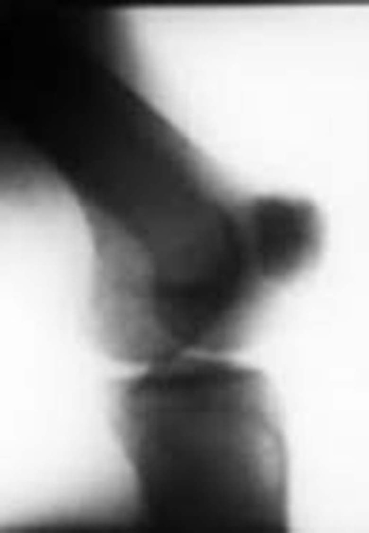 Roentgenfilm V i gruppen Alla filmer / Documentary hos Mohamad shop (642660)