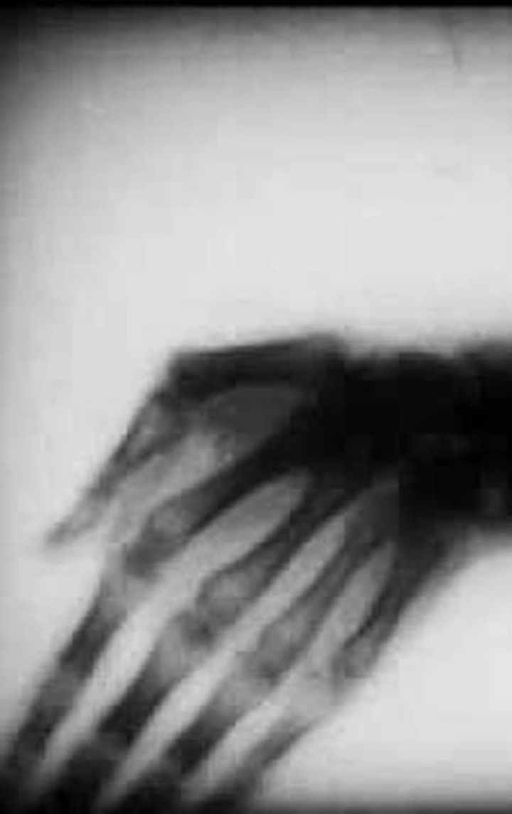 Roentgenfilm III and IV i gruppen Alla filmer / Documentary hos Mohamad shop (642662)